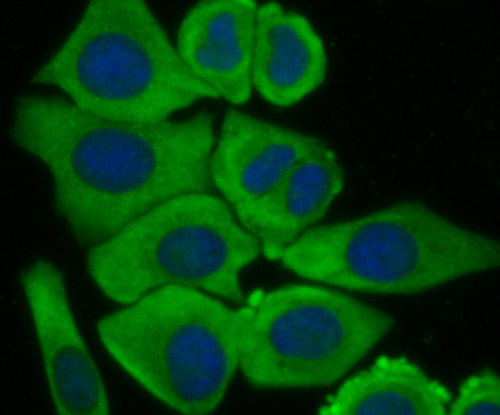 G6PD Antibody in Immunocytochemistry (ICC/IF)