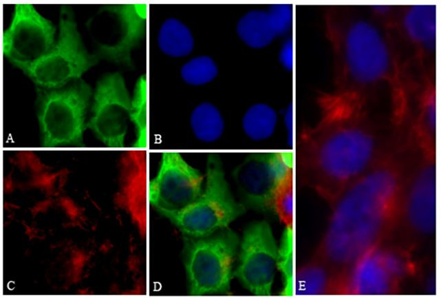 6x-His Tag (C-term) Antibody in Immunocytochemistry (ICC/IF)