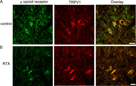 Mu Opioid Receptor Antibody in Immunohistochemistry (IHC)