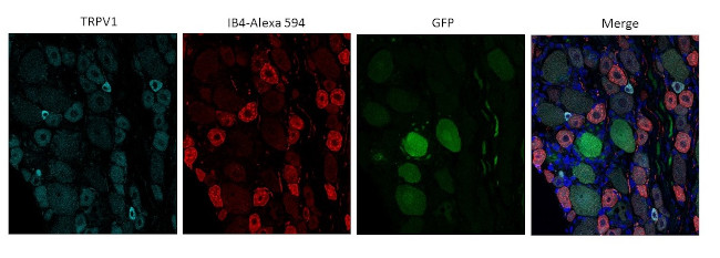 VR1 N-Terminus (TRPV1) Antibody in Immunocytochemistry (ICC/IF)