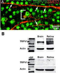 VR1 C-Terminus (TRPV1) - mouse specific Antibody in Immunohistochemistry (IHC)
