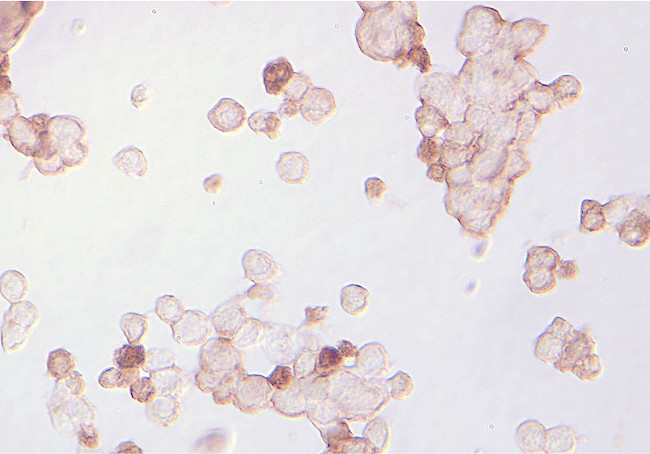 Musashi-1 Antibody in Immunocytochemistry (ICC/IF)