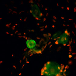 TRPA1 Antibody in Immunohistochemistry (IHC)
