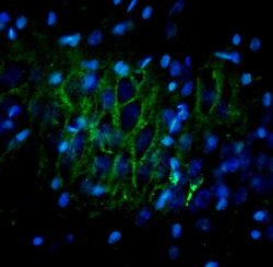 ORL 1 Antibody in Immunohistochemistry (IHC)