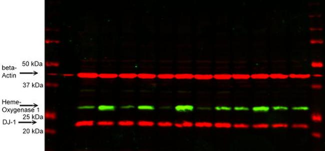 PARK7/DJ-1 Antibody in Western Blot (WB)