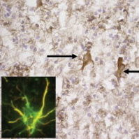 PTEN-induced kinase/PINK1 Antibody in Immunohistochemistry (IHC)