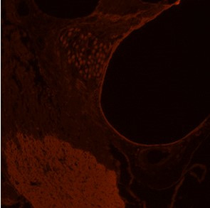 GLUT10 Antibody in Immunohistochemistry (IHC)