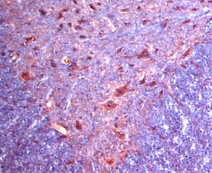 Alpha 2c Adrenergic Receptor Antibody in Immunohistochemistry (IHC)