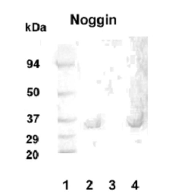 Noggin Antibody in Western Blot (WB)