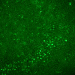 Nurr1 Antibody in Immunohistochemistry (IHC)