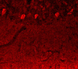 Notch3 Antibody in Immunohistochemistry (IHC)
