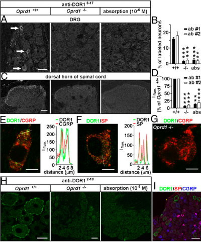Delta Opioid Receptor 3-17 Antibody in Immunohistochemistry (IHC)