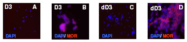 MOR-1C Antibody in Immunocytochemistry (ICC/IF)