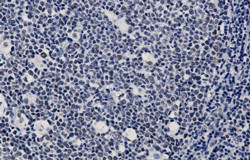 WTAP Antibody in Immunohistochemistry (Paraffin) (IHC (P))