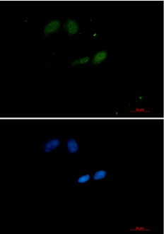 UBE2I Antibody in Immunocytochemistry (ICC/IF)