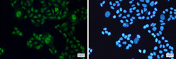 STAT3 Antibody in Immunocytochemistry (ICC/IF)