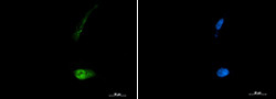 SQSTM1 Antibody in Immunocytochemistry (ICC/IF)