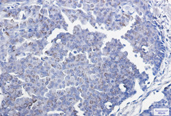 SMAD3 Antibody in Immunohistochemistry (Paraffin) (IHC (P))