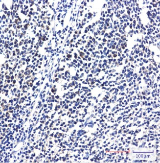 RPS20 Antibody in Immunohistochemistry (Paraffin) (IHC (P))