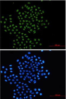 RAD21 Antibody in Immunocytochemistry (ICC/IF)