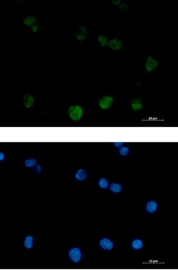 PRKCB Antibody in Immunocytochemistry (ICC/IF)
