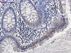 SPP1 Antibody in Immunohistochemistry (Paraffin) (IHC (P))