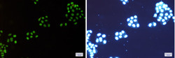 NAT10 Antibody in Immunocytochemistry (ICC/IF)