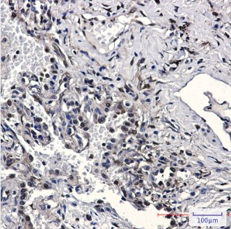 NAMPT Antibody in Immunohistochemistry (Paraffin) (IHC (P))