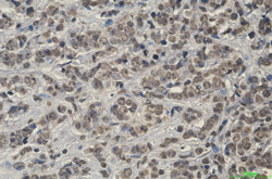 KEAP1 Antibody in Immunohistochemistry (Paraffin) (IHC (P))