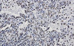 ILF3 Antibody in Immunohistochemistry (Paraffin) (IHC (P))