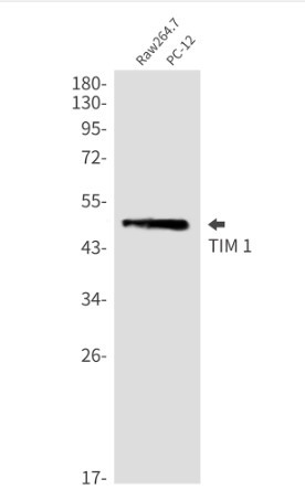 HAVCR1 Antibody in Western Blot (WB)
