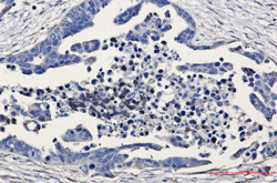 GSK3B Antibody in Immunohistochemistry (Paraffin) (IHC (P))