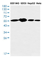 GSDME Antibody in Western Blot (WB)