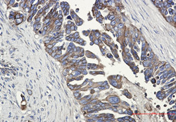 CDH1 Antibody in Immunohistochemistry (Paraffin) (IHC (P))