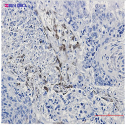 PTGS2 Antibody in Immunohistochemistry (Paraffin) (IHC (P))