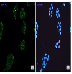 COL3A1 Antibody in Immunocytochemistry (ICC/IF)