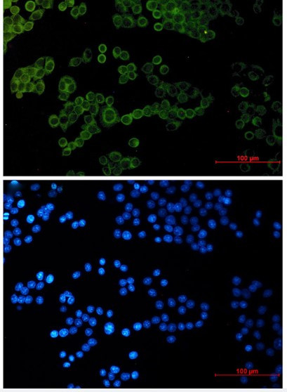 COL1A1 Antibody in Immunocytochemistry (ICC/IF)