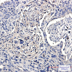 CCT2 Antibody in Immunohistochemistry (Paraffin) (IHC (P))