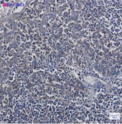 TUBB Antibody in Immunohistochemistry (Paraffin) (IHC (P))
