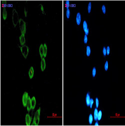 ATG5 Antibody in Immunocytochemistry (ICC/IF)