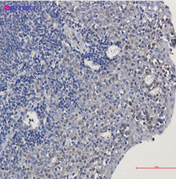 TUBA4A Antibody in Immunohistochemistry (Paraffin) (IHC (P))