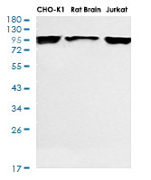 PDCD6IP Antibody in Western Blot (WB)