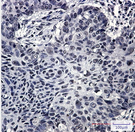 SRSF3 Antibody in Immunohistochemistry (Paraffin) (IHC (P))