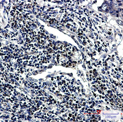 RNF2 Antibody in Immunohistochemistry (Paraffin) (IHC (P))