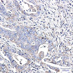 YBX1 Antibody in Immunohistochemistry (Paraffin) (IHC (P))