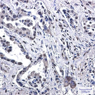 VPS35 Antibody in Immunohistochemistry (Paraffin) (IHC (P))