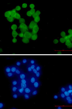 UBB Antibody in Immunocytochemistry (ICC/IF)