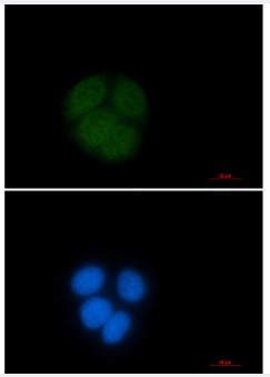 UBE2C Antibody in Immunocytochemistry (ICC/IF)