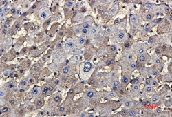 TSC2 Antibody in Immunohistochemistry (Paraffin) (IHC (P))