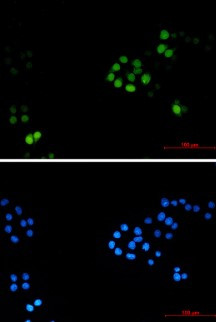 TPX2 Antibody in Immunocytochemistry (ICC/IF)